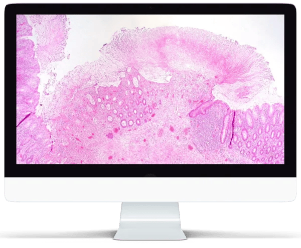 calopix promote transistion to digital pathology powered by AI calopix promote transistion to digital pathology powered by AI
