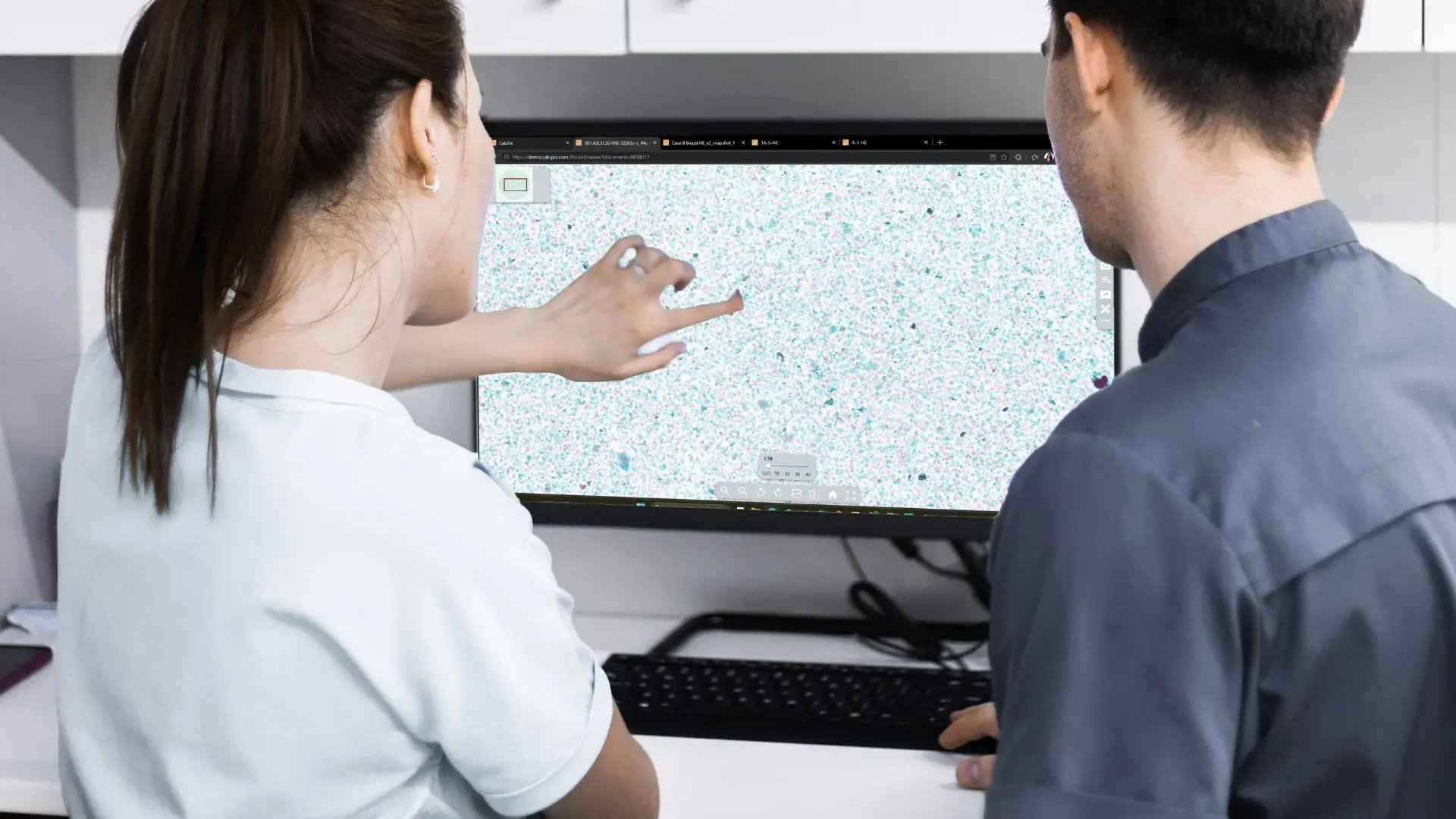 SGI pathologie numérique