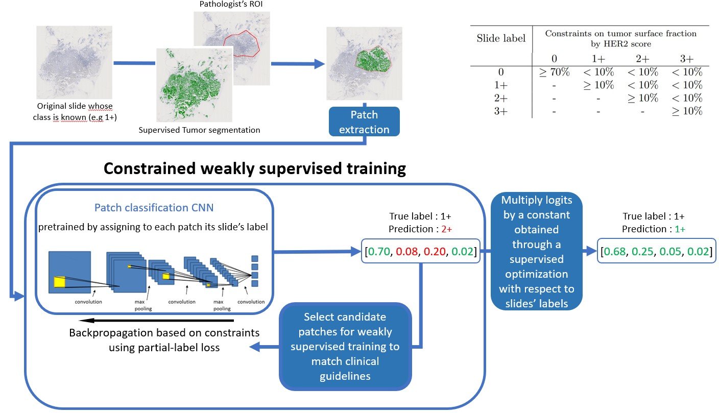 Interpretable HER2 scoring by evaluating clinical Guidelines through weakly supervised, constrained Deep Learning