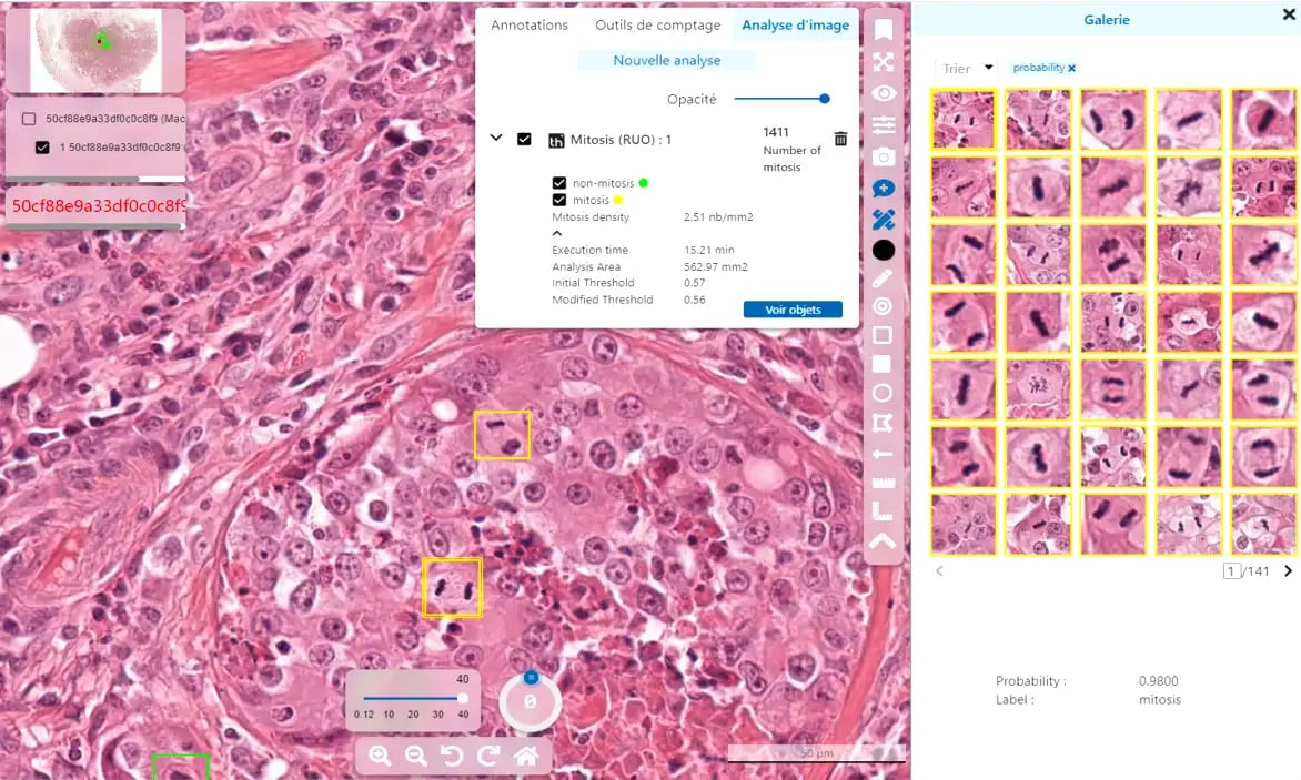 Mitosis_screen_tribun_health