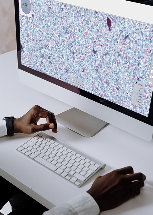 Pathologist working on a digital pathology slide