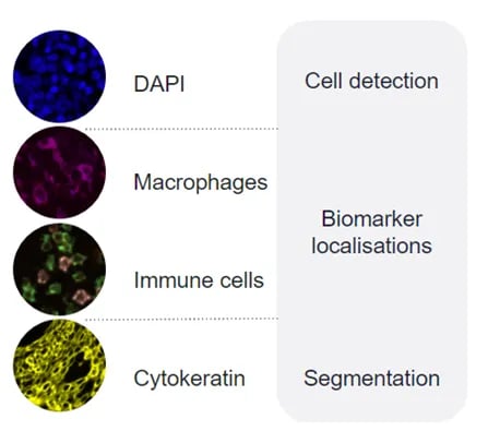tribun-health-workflow-for-multiplexed-image-analysis