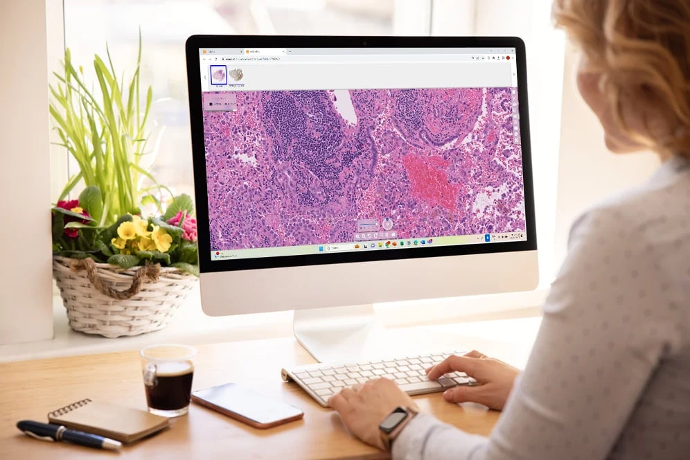 women working on a digital pathology case