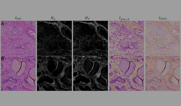 Collagen prediction and virtual saffron staining from HE