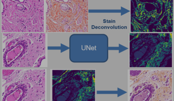 Assessment of hepatic fibrosis using HE staining I Tribun Health