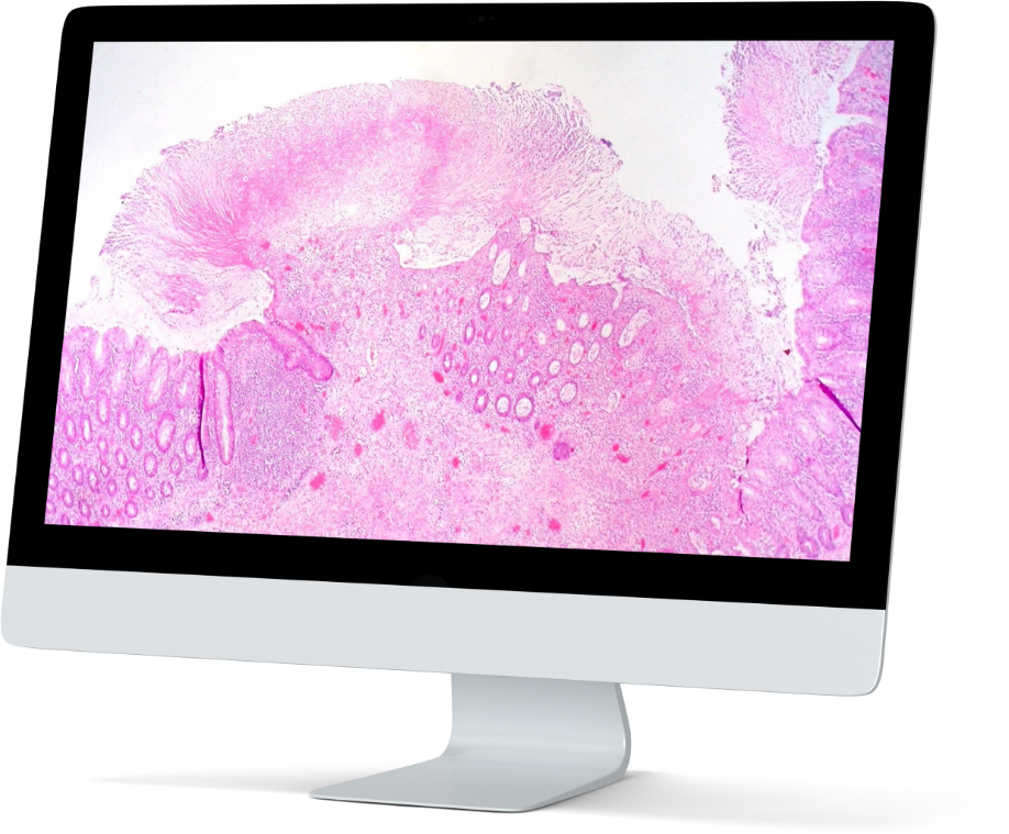 Screen 1